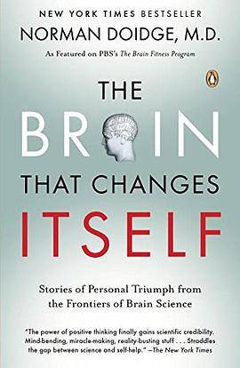 The Brain That Changes Itself