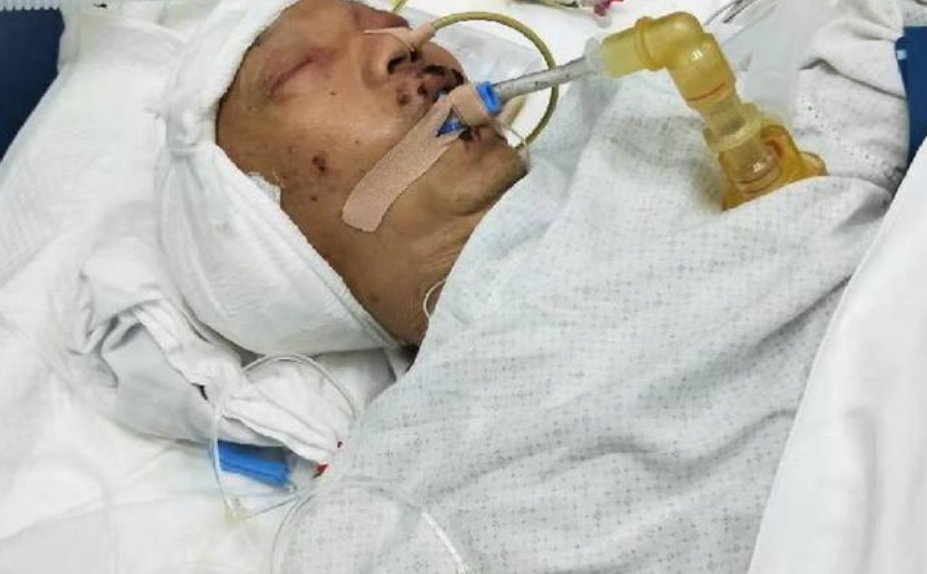 啤酒大王李大红去世,去世的原因是什么?